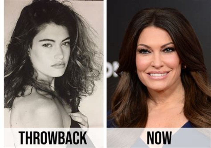 Kimberly Guilfoyle: A Journey Of Transformation Before And After
